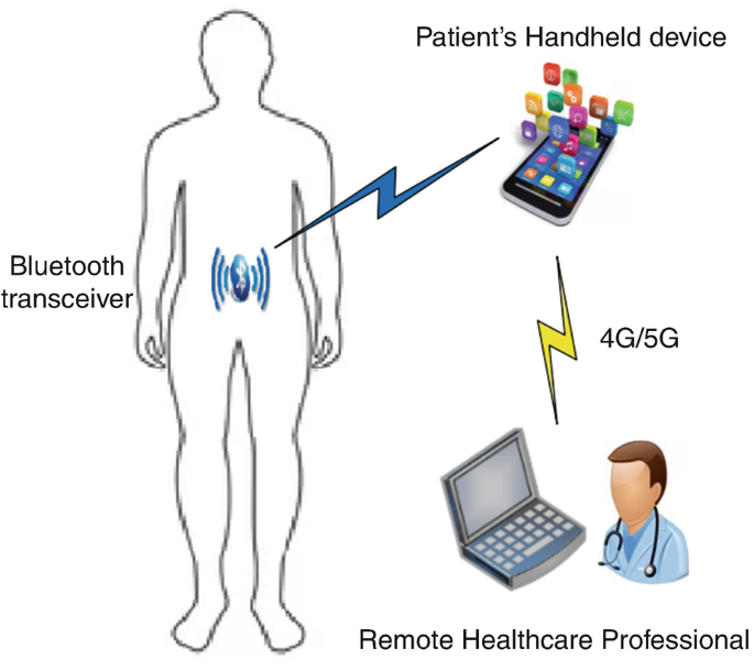 An illustration of a human body with a Bluetooth transceiver in the abdominal section transmitting information to a patient's handheld device, which further transfers information through 4 G or 5 G to a remote healthcare professional.