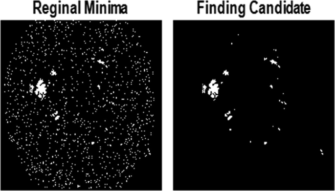 2 images of extracted pictures. 1. Regional minima with dotted patterns throughout and a clustered patch of space towards the mid-left. 2. Finding candidate, with clustered patches of space towards the mid-left and a few more in a circular pattern in the dark background.