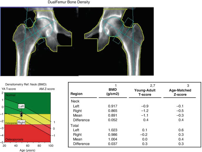 DXA Quiz and Analysis SpringerLink