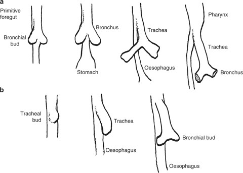 figure 1_22