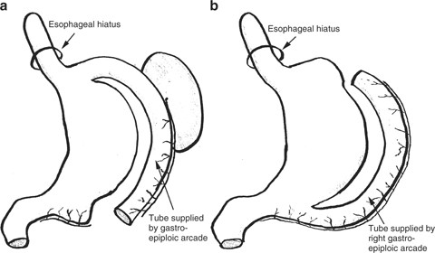 figure 25_22