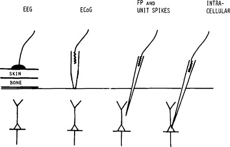 Extracellular Single-Unit Methods | SpringerLink