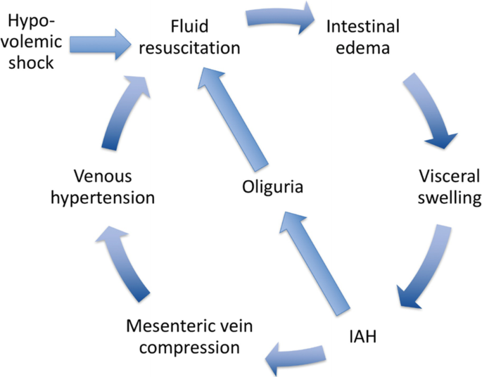 The 4-indications of Fluid Therapy: Resuscitation, Replacement ...