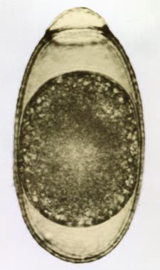 Gnathostoma Spinigerum Springerlink