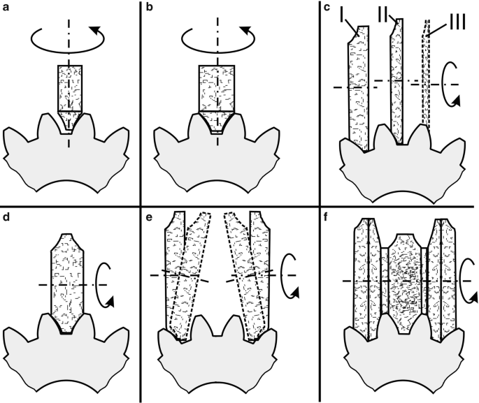 Gear Grinding DEFINITION AND MEANING – Rehook