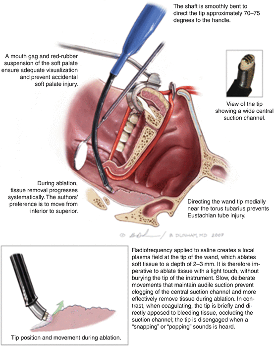 figure 130