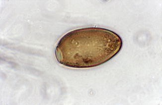 Fasciola hepatica | SpringerLink