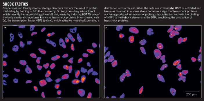 Health Tip on New Treatment that Shows Promise in Niemann-Pick