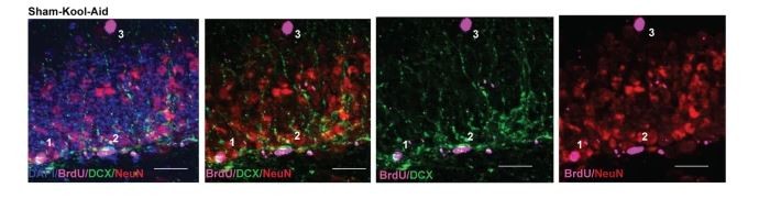 Featured Article Picture