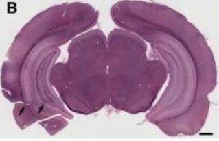 Elder et al., 2013 © Elder et al., 2013