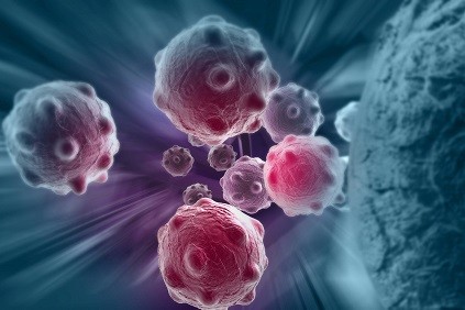 tumor © vitanovski / Fotolia