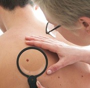 Skin Cancer Awareness Month © Alexander Raths / stock.adobe.com