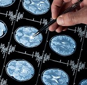 Sarcoma Awareness Month © haydenbird / Getty Images / iStock