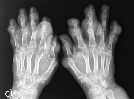Clinical Rheumatology | Clinical images - open for submission