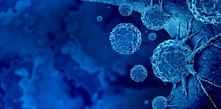 Biomarkers for cancer immunotherapy © © wildpixel / Getty Images / iStock