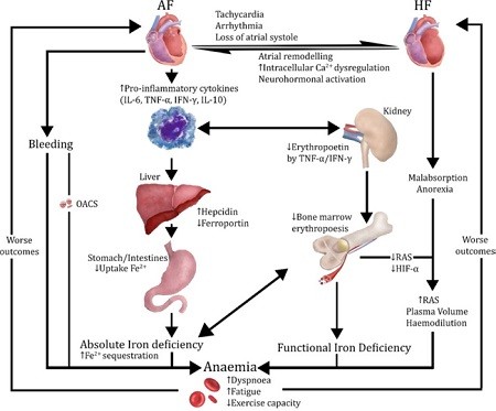 Anemia and iron deficiency in patients with atrial fibrillation