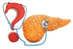 A pancreas with an interrogation sign