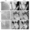 A clinical strategy to improve the diagnostic performance of 3T non-contrast coronary MRA and noninvasively evaluate coronary distensibility