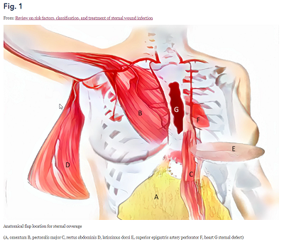 Home page | Journal of Cardiothoracic Surgery