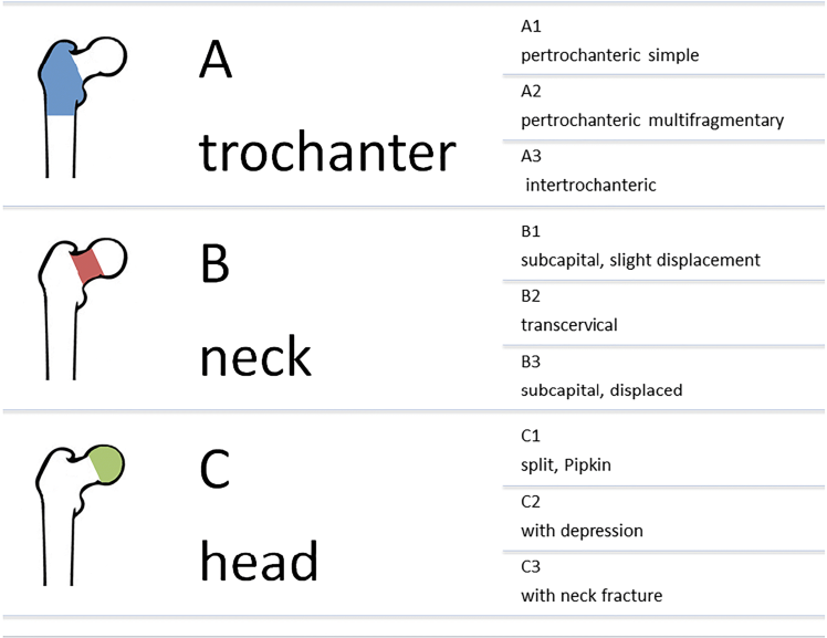 Table 1 Biomechanics Of Osteoporotic Fracture Fixation Springerlink