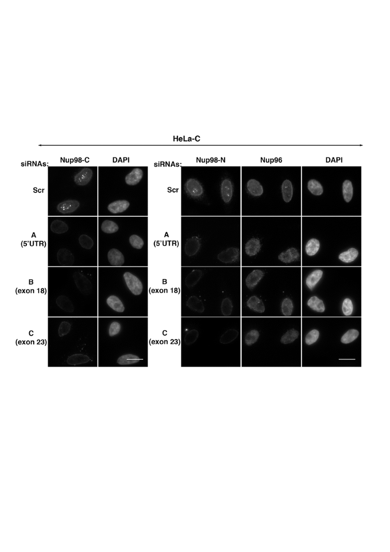 nuclear Formation ... of bodies in HeLa Nup98-containing HeLa Nup98-containing ... Formation of in bodies nuclear