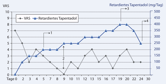 progredient bedeutung