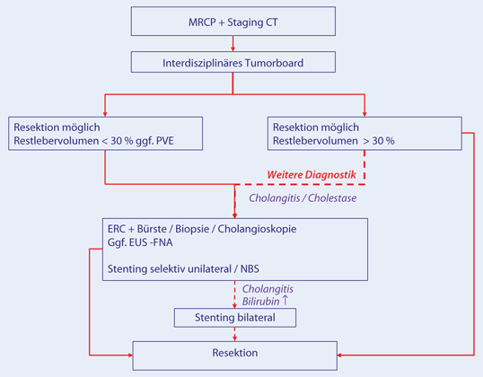 Klatskin Tumoren Rationale Diagnostik Und Staging Springerlink