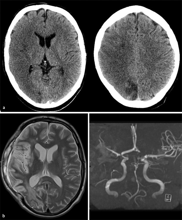 Syphilis SpringerLink