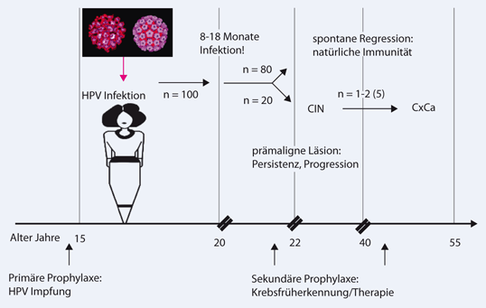 Behandlung Papillomavirus in Nürnberg Behandlung Papillomavirus in Nürnberg