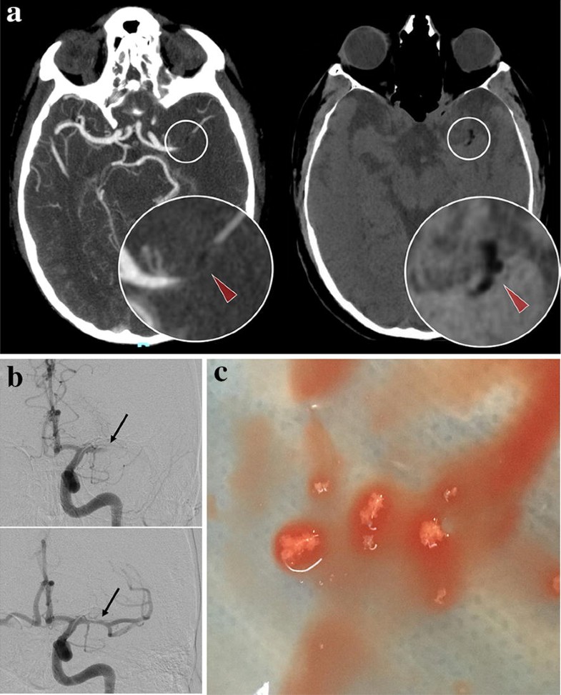 Fig. 1