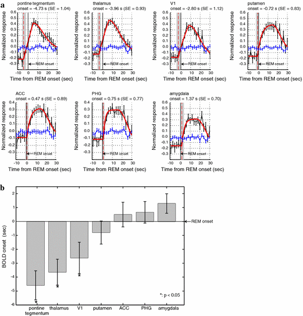 Human Brain Activity Time Locked To Rapid Eye Movements During Rem