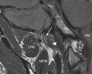 Imaging of the Eustachian tube and its function: a systematic review ...