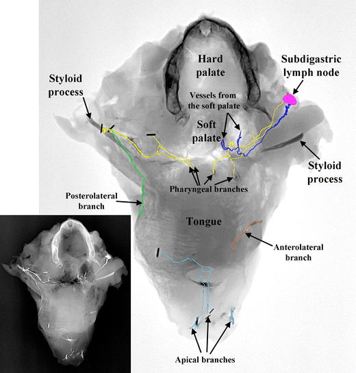 Lymphatic drainage of the tongue and the soft palate SpringerLink