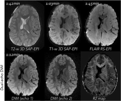 Gay sex mri