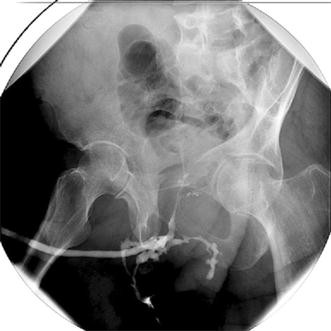 the-watering-can-perineum-springerlink