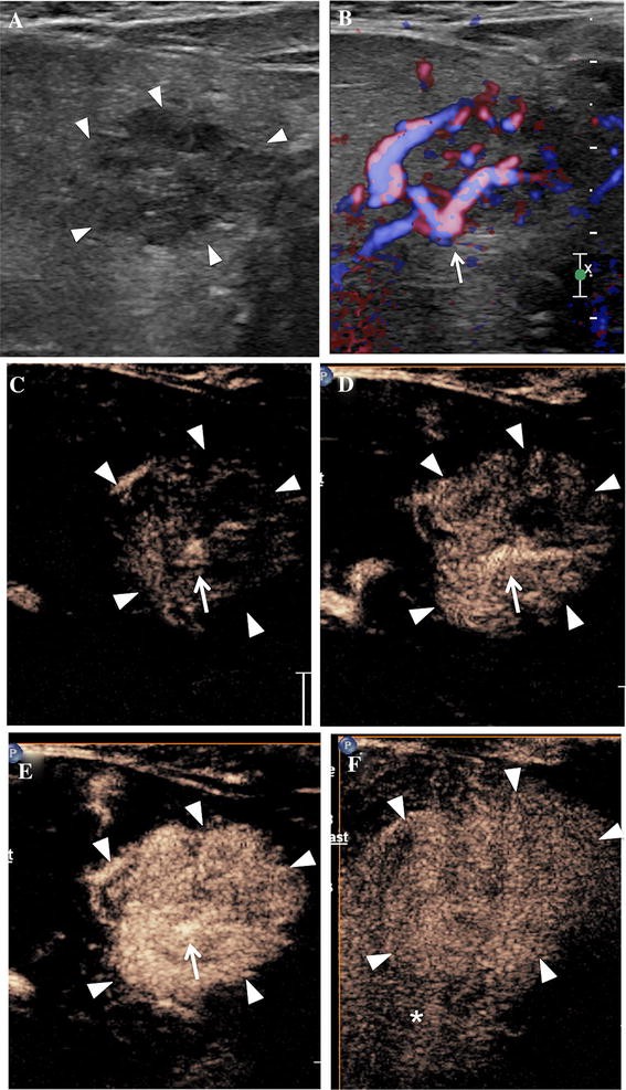abdominal sonogram abdominal sonogram