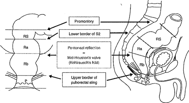 Lateral Lymph Node Dissection for Lower Rectal Cancer | SpringerLink