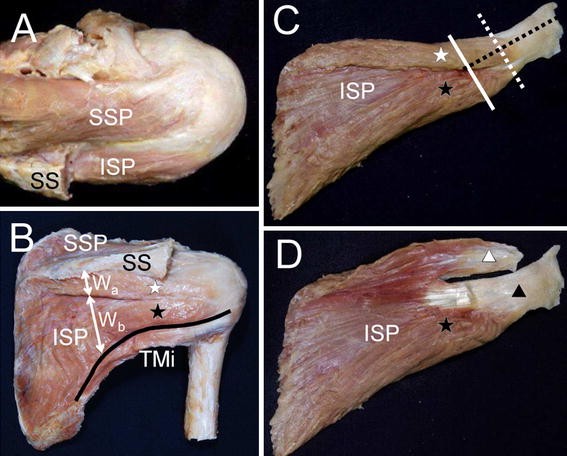 An anatomical study of the transverse part of the infraspinatus muscle ...