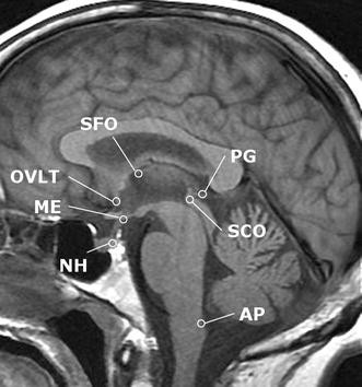 The circumventricular organs of the brain: conspicuity on clinical 3T ...