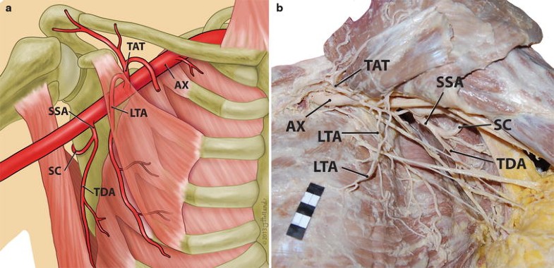 The lateral thoracic artery revisited | SpringerLink