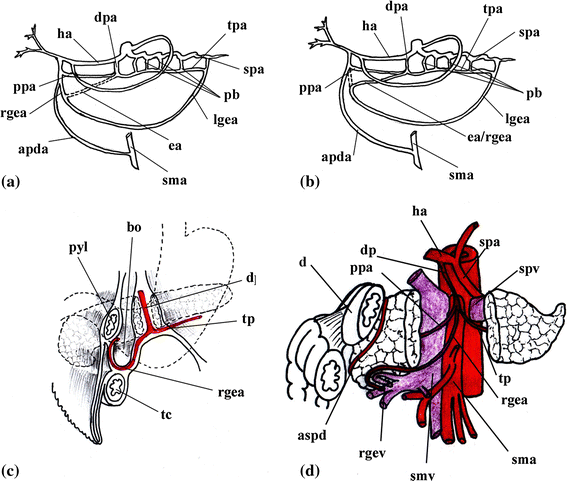 A Rare And Complex Anatomic Variation Artery