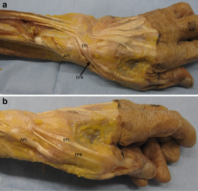 extensor tendon compartments extensor tendon compartments