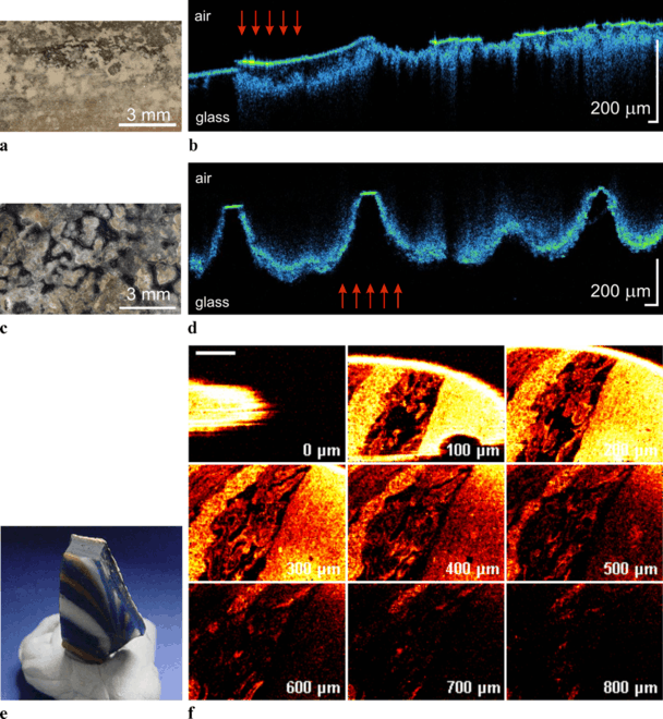 Optical Coherence Tomography Its Role In The Non Invasive - 