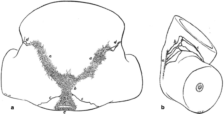 Exceptional dissemination of perineal tuberculosis up to the right