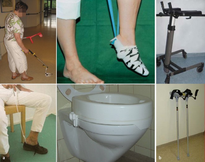 Postoperatives Management nach Hüft und Knieendoprothetik SpringerLink