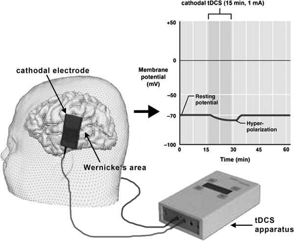 auditory hallucination before sleep auditory hallucination before sleep