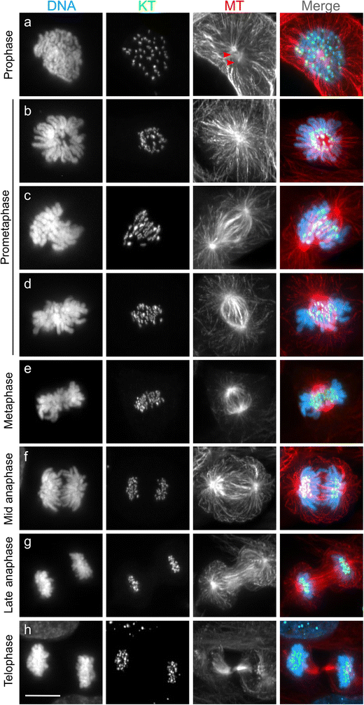 A guide to classifying mitotic stages and mitotic defects in fixed ... Biology Diagrams