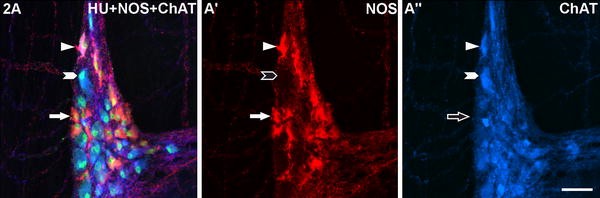 Partial Selective Survival Of Nitrergic Neurons In Chagasic Megacolon Springerlink