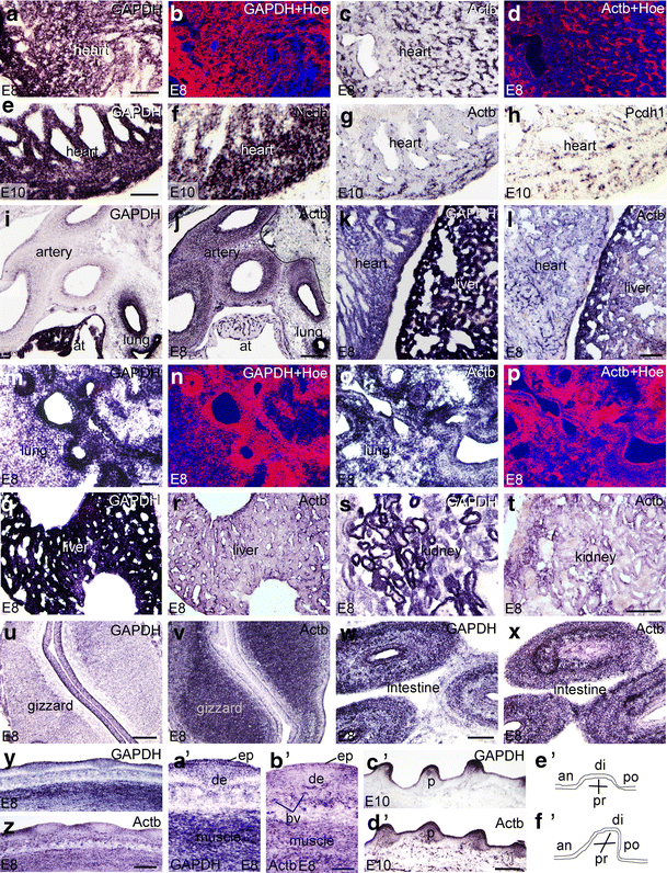 Histological evidence housekeeping genes betaactin and GAPDH are of