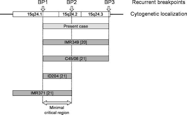 A Further Case Of The Recurrent 15q24 Microdeletion Syndrome, Detected ...